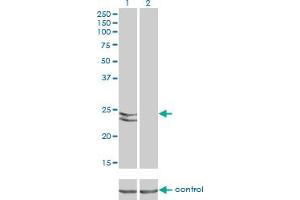 Western Blotting (WB) image for anti-RAB27A, Member RAS Oncogene Family (RAB27A) (AA 122-222) antibody (ABIN598569) (RAB27A 抗体  (AA 122-222))