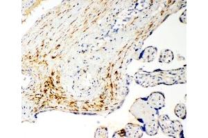 Immunohistochemistry (IHC) image for anti-Solute Carrier Family 16 (Monocarboxylic Acid Transporters), Member 4 (SLC16A4) (N-Term) antibody (ABIN3032674)