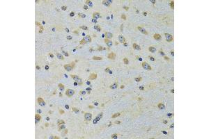 Immunohistochemistry of paraffin-embedded rat brain using DARS antibody (ABIN5973949) at dilution of 1/100 (40x lens). (DARS 抗体)