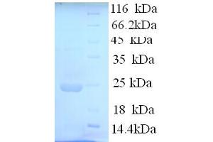 SDS-PAGE (SDS) image for Interferon, alpha 10 (IFNa10) (AA 24-189) protein (His tag) (ABIN5713528)