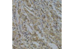 Immunohistochemistry (Paraffin-embedded Sections) (IHC (p)) image for anti-Golgi-Associated, gamma Adaptin Ear Containing, ARF Binding Protein 2 (GGA2) (AA 1-300) antibody (ABIN3021665)