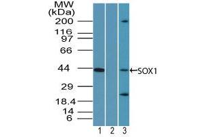 Image no. 1 for anti-SRY (Sex Determining Region Y)-Box 1 (SOX1) (AA 350-400) antibody (ABIN960349) (SOX1 抗体  (AA 350-400))
