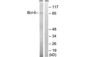 Western blot analysis of extracts from 293 cells, using Bcl-6 (Ab-333) Antibody. (BCL6 抗体  (AA 299-348))