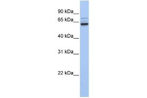 WB Suggested Anti-GEFT Antibody Titration: 0. (ARHGEF25/GEFT 抗体  (C-Term))