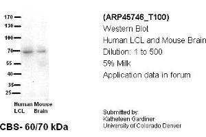 Image no. 2 for anti-Cystathionine-beta-Synthase (CBS) (N-Term) antibody (ABIN2782348) (CBS 抗体  (N-Term))