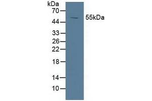 Detection of LXRa in Porcine Spleen Tissue using Polyclonal Antibody to Liver X Receptor Alpha (LXRa) (NR1H3 抗体  (AA 95-434))