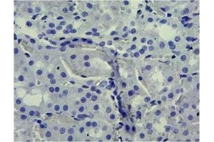 Immunohistochemistry (IHC) image for anti-Solute Carrier Family 5 (Sodium/glucose Cotransporter), Member 1 (SLC5A1) (Internal Region) antibody (ABIN870680)