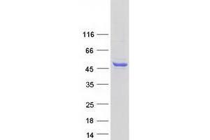 Western Blotting (WB) image for Sphingosine Kinase 1 (SPHK1) (Transcript Variant 1) protein (Myc-DYKDDDDK Tag) (ABIN2732578)