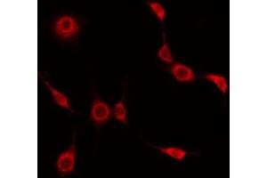 ABIN6275026 staining HuvEc by IF/ICC. (BEND4 抗体  (Internal Region))
