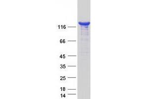 Validation with Western Blot (Phospholipase C gamma 2 Protein (PLCG2) (Myc-DYKDDDDK Tag))