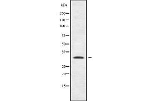 Western blot analysis SHOX using MCF7 whole cell lysates (SHOX 抗体  (N-Term))