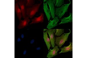 ABIN6257961 and ABIN6274900 staining  cells by IF/ICC. (BOK 抗体  (N-Term))