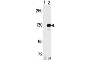 Image no. 1 for anti-UPF1 Regulator of Nonsense Transcripts Homolog (UPF1) (N-Term) antibody (ABIN357204) (RENT1/UPF1 抗体  (N-Term))