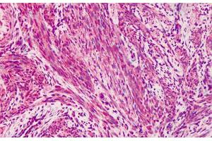 Human Muscle: Formalin-Fixed, Paraffin-Embedded (FFPE) (Vinculin 抗体)