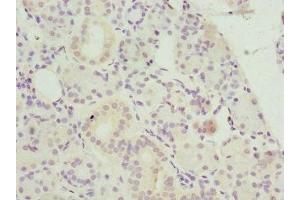 Immunohistochemistry of paraffin-embedded human pancreatic tissue using ABIN7145599 at dilution of 1:100 (Biliverdin Reductase 抗体  (AA 1-296))