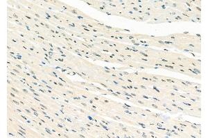 ABIN6265726 and ABIN6277994 at 1/100 staining Rat heart tissue by IHC-P.