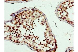 IHC image of ABIN7164137 diluted at 1:300 and staining in paraffin-embedded human testis tissue performed on a Leica BondTM system. (PBX1 抗体  (AA 315-430))