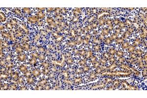 Immunohistochemistry (IHC) image for anti-Sequestosome 1 (SQSTM1) (AA 136-400) antibody (ABIN7435412)