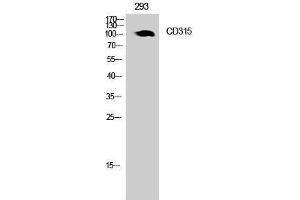 Western Blotting (WB) image for anti-Prostaglandin F2 Receptor Negative Regulator (PTGFRN) (Internal Region) antibody (ABIN3178983) (PTGFRN 抗体  (Internal Region))