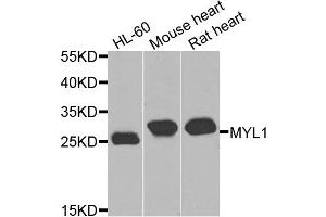 Western blot analysis of extracts of various cell lines, using MYL1 antibody (ABIN5974855) at 1/1000 dilution. (MYL1 抗体)
