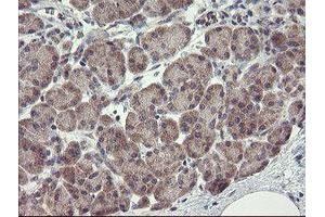 Image no. 3 for anti-rho GTPase Activating Protein 2 (ARHGAP2) antibody (ABIN1499627)