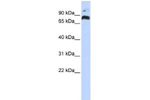 WB Suggested Anti-PHF21A Antibody Titration:  0. (PHF21A 抗体  (Middle Region))