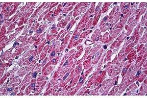 Immunohistochemistry (Formalin-fixed Paraffin-embedded Sections) (IHC (fp)) image for anti-ATP Synthase, H+ Transporting, Mitochondrial F1 Complex, alpha Subunit 1, Cardiac Muscle (ATP5A1) (AA 201-250) antibody (ABIN2878786)