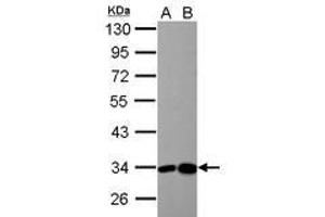 Image no. 4 for anti-3-hydroxyisobutyrate Dehydrogenase (HIBADH) (AA 1-257) antibody (ABIN1501919) (HIBADH 抗体  (AA 1-257))