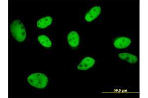 Immunofluorescence of monoclonal antibody to GTF2I on HeLa cell. (GTF2I 抗体  (AA 36-274))