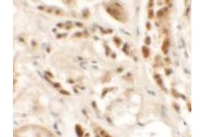Immunohistochemical analysis of SIGLEC15 in human kidney tissue with SIGLEC15 polyclonal antibody  at 2. (SIGLEC15 抗体  (N-Term))