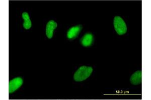 Immunofluorescence (IF) image for anti-Zinc Finger Protein 101 (ZNF101) (AA 112-201) antibody (ABIN530166)