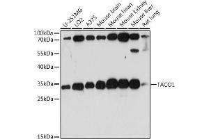Western blot analysis of extracts of various cell lines, using T antibody (ABIN7266436) at 1:1000 dilution. (TACO1 抗体  (AA 1-297))