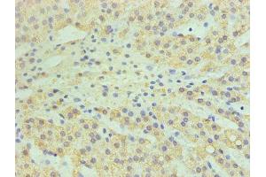 Immunohistochemistry (IHC) image for anti-Cytochrome P450, Family 11, Subfamily A, Polypeptide 1 (CYP11A1) (AA 40-521) antibody (ABIN7147608)