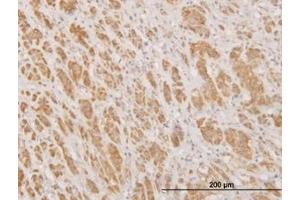 Image no. 1 for anti-N-Methylpurine-DNA Glycosylase (MPG) (AA 1-90) antibody (ABIN598820) (MPG 抗体  (AA 1-90))