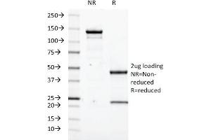 SDS-PAGE Analysis Purified Transglutaminase II Mouse Monoclonal Antibody (SPM358). (Transglutaminase 2 抗体)
