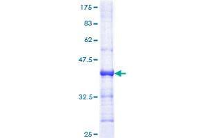 PMS1 Protein (AA 26-135) (GST tag)