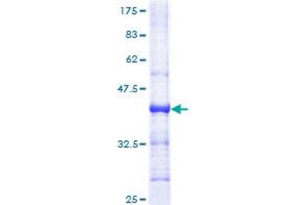 PMS1 Protein (AA 26-135) (GST tag)