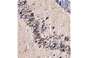 IHC analysis of MDH2 using anti-MDH2 antibody (ABIN7602618).