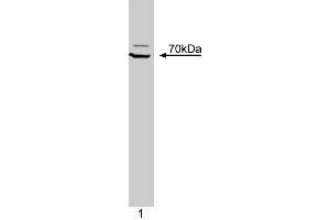 Western blot analysis of ZAP-70 Kinase on a Jurkat cell lysate (Human T-cell leukemia, ATCC TIB-152). (ZAP70 抗体  (AA 468-619))