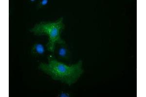 Anti-ALDH1L1 mouse monoclonal antibody (ABIN2452750) immunofluorescent staining of COS7 cells transiently transfected by pCMV6-ENTRY ALDH1L1 (RC213720). (ALDH1L1 抗体)