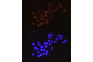Immunofluorescence analysis of HeLa cells using METTL3 Rabbit mAb  at dilution of 1:100 (40x lens). (METTL3 抗体)