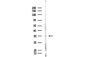 Western blot analysis of lysates from Rat liver, using OR2V2 Antibody at 1/1000 dilution.