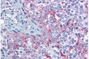 Human Tonsil (formalin-fixed, paraffin-embedded) stained with MTBP antibody ABIN213954 at 10 ug/ml followed by biotinylated goat anti-rabbit IgG secondary antibody ABIN481713, alkaline phosphatase-streptavidin and chromogen. (MTBP 抗体  (AA 122-139))