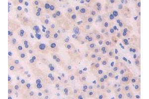 DAB staining on IHC-P; Samples: Human Liver Tissue (CDNF 抗体  (AA 33-187))