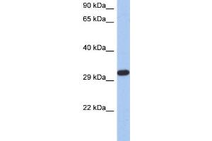WB Suggested Anti-CAPZA3 Antibody Titration: 0. (CAPZA3 抗体  (N-Term))