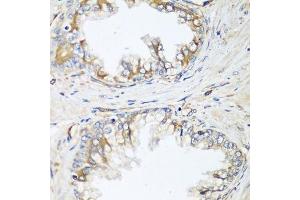 Immunohistochemistry of paraffin-embedded human prostate using HPSE2 antibody. (Heparanase 2 抗体  (AA 42-242))