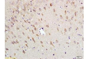 Formalin-fixed and paraffin embedded: rat brain tissue labeled with Anti-NK-2R Polyclonal Antibody , Unconjugated at 1:200 followed by conjugation to the secondary antibody and DAB staining (TACR2 抗体  (AA 223-300))