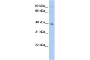 Western Blotting (WB) image for anti-Outer Dense Fiber of Sperm Tails 2 (ODF2) antibody (ABIN2463576) (ODF2 抗体)