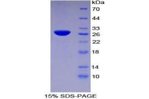 SDS-PAGE (SDS) image for Tissue Factor Pathway Inhibitor 2 (TFPI2) (AA 23-235) protein (His tag) (ABIN1880057)