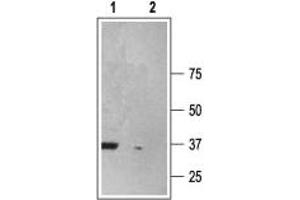 Western blot analysis of rat brain membranes:  - 1.